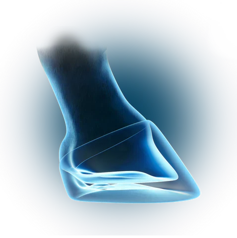 Winter Hoofcare Tips